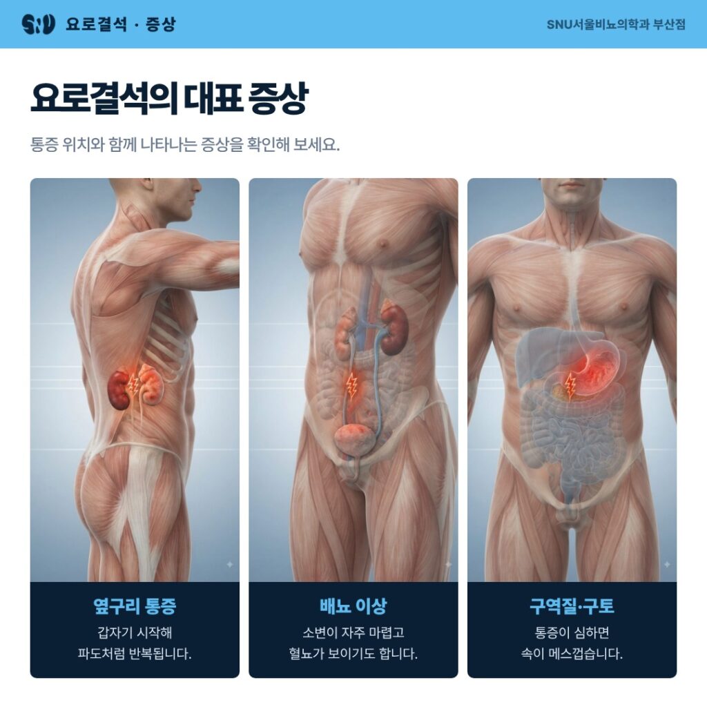 통증 없이 혈뇨만 보일 때, 요로결석일까요? - SNU서울비뇨의학과 부산점